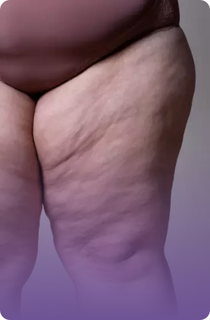 Tratamento Cirúrgico